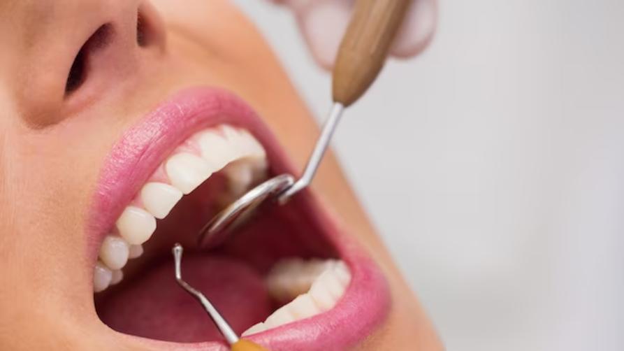Ceny zubních fazet a zubních implantátů v Turecku