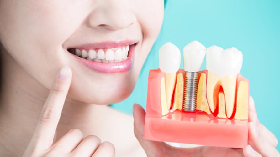 Kliniky zubních implantátů a náklady na implantáty v Bristolu