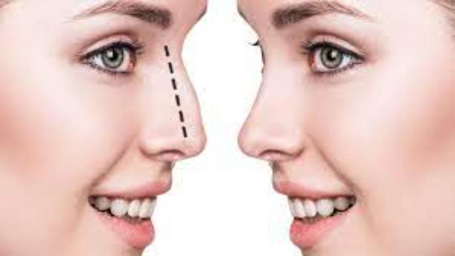 鼻子美学适用于哪些情况？