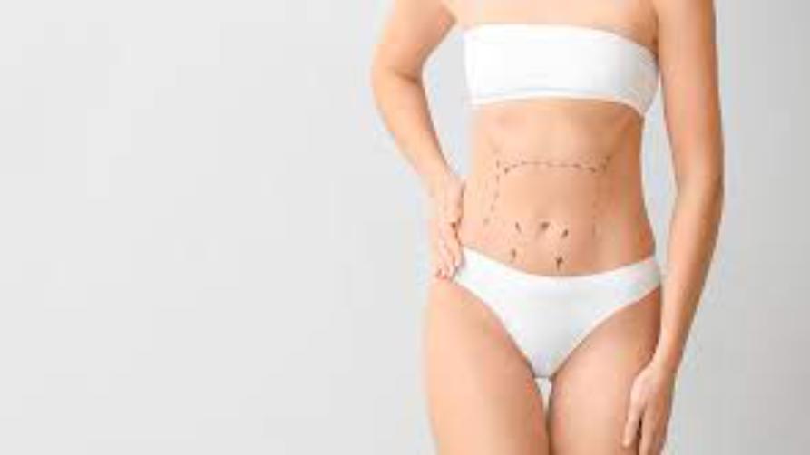 Vaser Liposuction ile Yağ Aldırma Nedir?