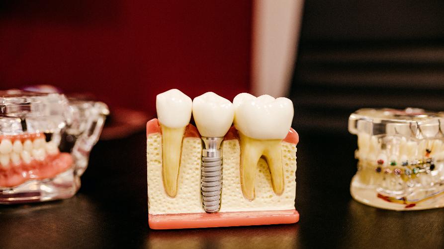 Skvělé možnosti pro zubní ošetření v Istanbul Beşiktaş!