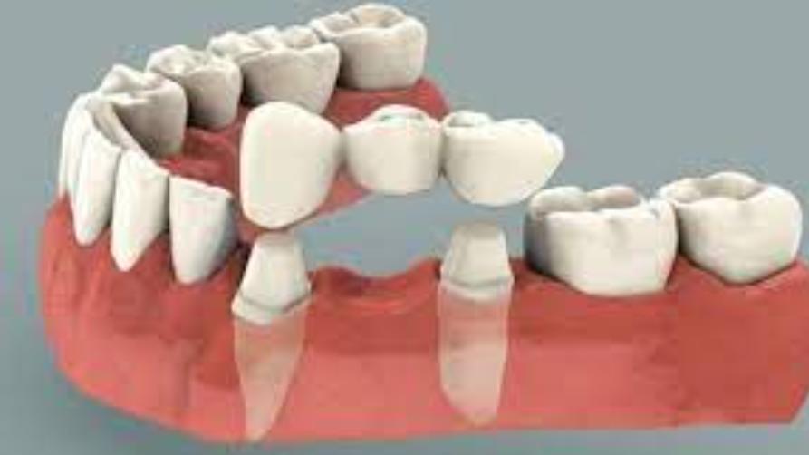 Harga Sasak dental di Turki