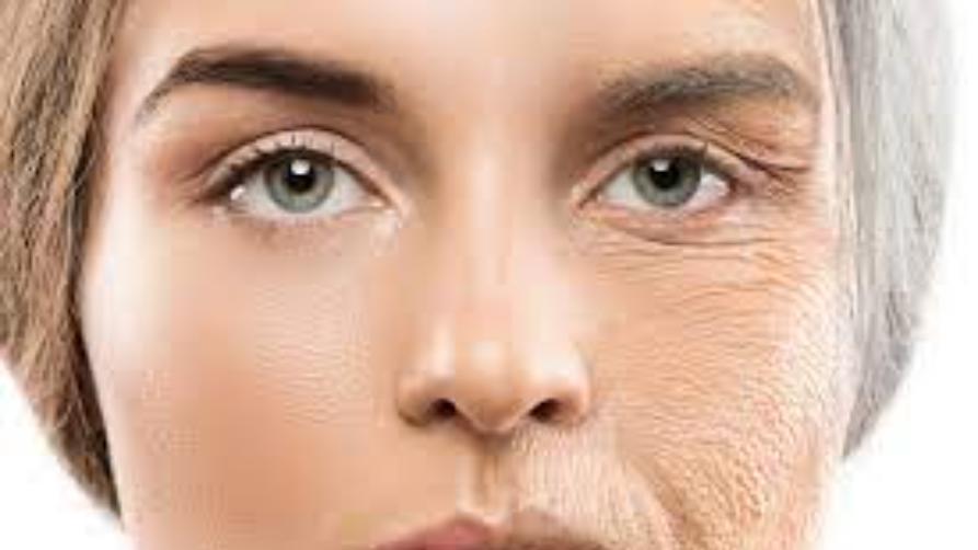 土耳其面部整形手术中的面部和颈部提升应用