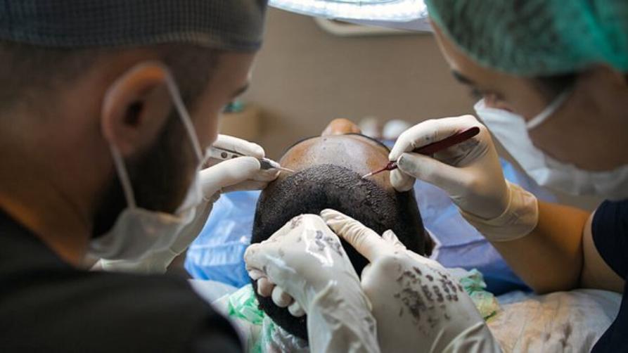 Трансплантация на коса цени Турция