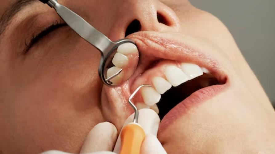 $399 Dental Implant Fact - Tus nqi tiag