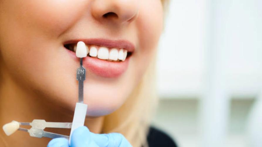 Ceny a postup zubní fazety