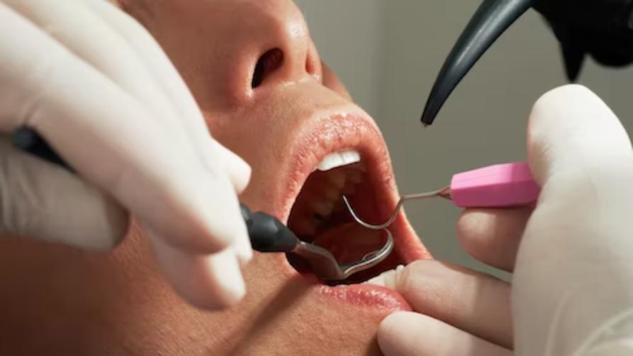 Hvilken by i Tyrkia er best å få implantat og tannbehandling?